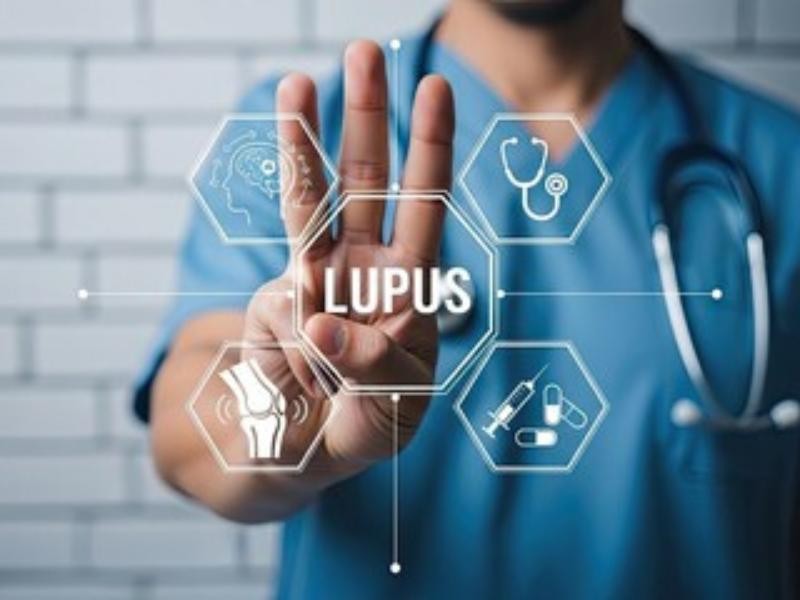 Anifrolumabe (Saphnelo): Indicação, Acesso, Direitos dos Pacientes.